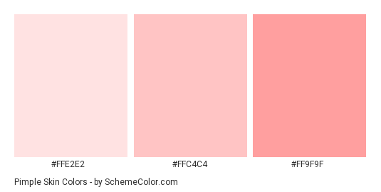 Pimple Skin - Color scheme palette thumbnail - #ffe2e2 #ffc4c4 #ff9f9f 